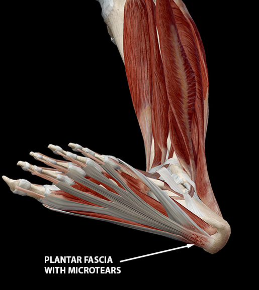 Common Ligament Injuries And Disorders 3610